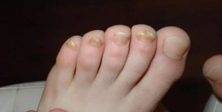 Anerer sprooch liesen